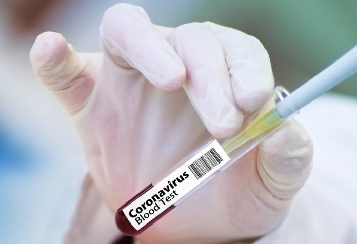 Szósta ofiara koronawirusa w powiecie lubińskim